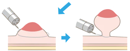 EMR2